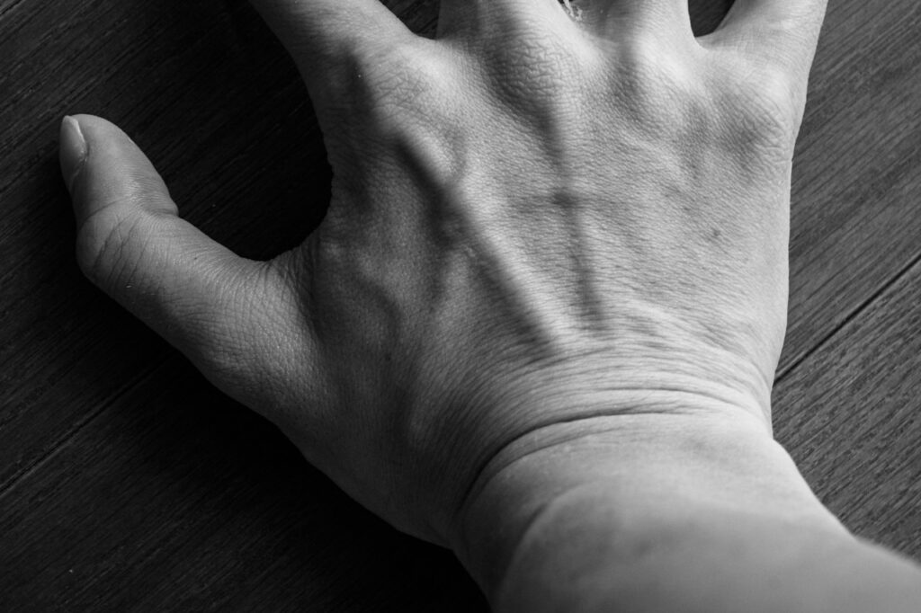 Ganglion Cyst and Vitamin Deficiency: What's the Link? (2026)