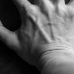 Ganglion Cyst and Vitamin Deficiency: What’s the Link? (2026)