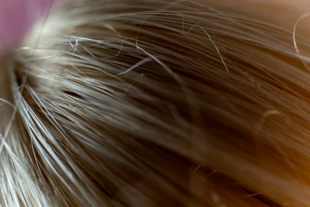 Vitamin D and Hair Loss: What the Research Actually Shows (2026)
