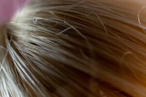 Vitamin D and Hair Loss: What the Research Actually Shows (2026)